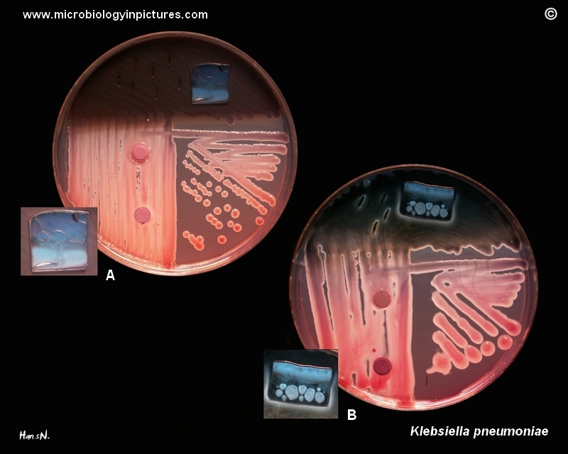 Klebsiella pneumoniae basic biochemical properties